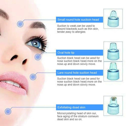 Cell Operated Blackhead Removal Machine Derma Suction 4 in 1 Black Head Remover Machine Cell Operated Blackhead Removal Machine Derma Suction 4 in 1 Black Head Remover Machine