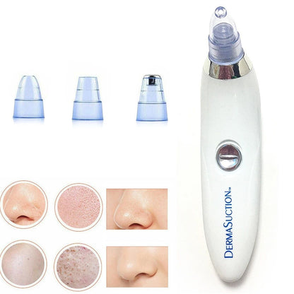 Cell Operated Blackhead Removal Machine Derma Suction 4 in 1 Black Head Remover Machine Cell Operated Blackhead Removal Machine Derma Suction 4 in 1 Black Head Remover Machine