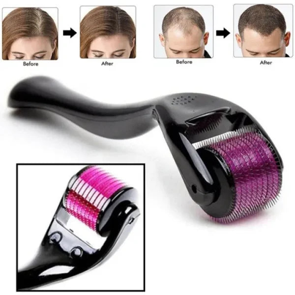 Derma Roller 0.5mm for Hair & Skin Therapy | 540 Titanium Micro-Needles Derma Roller